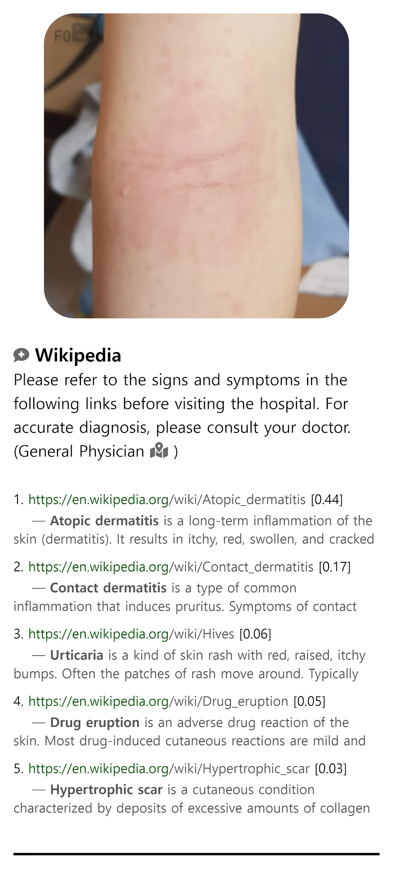 Model Dermatol – Skin Disease | Indus Appstore | Screenshot