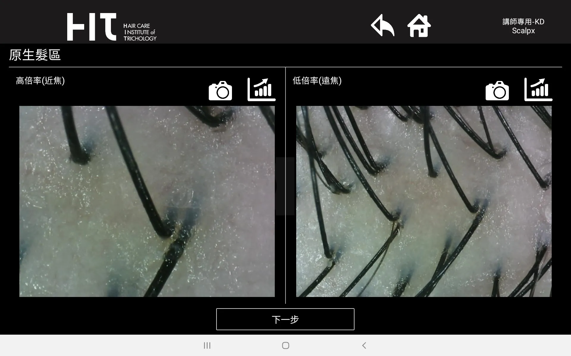 Scalpx專業頭皮檢測軟體-雲端版 | Indus Appstore | Screenshot