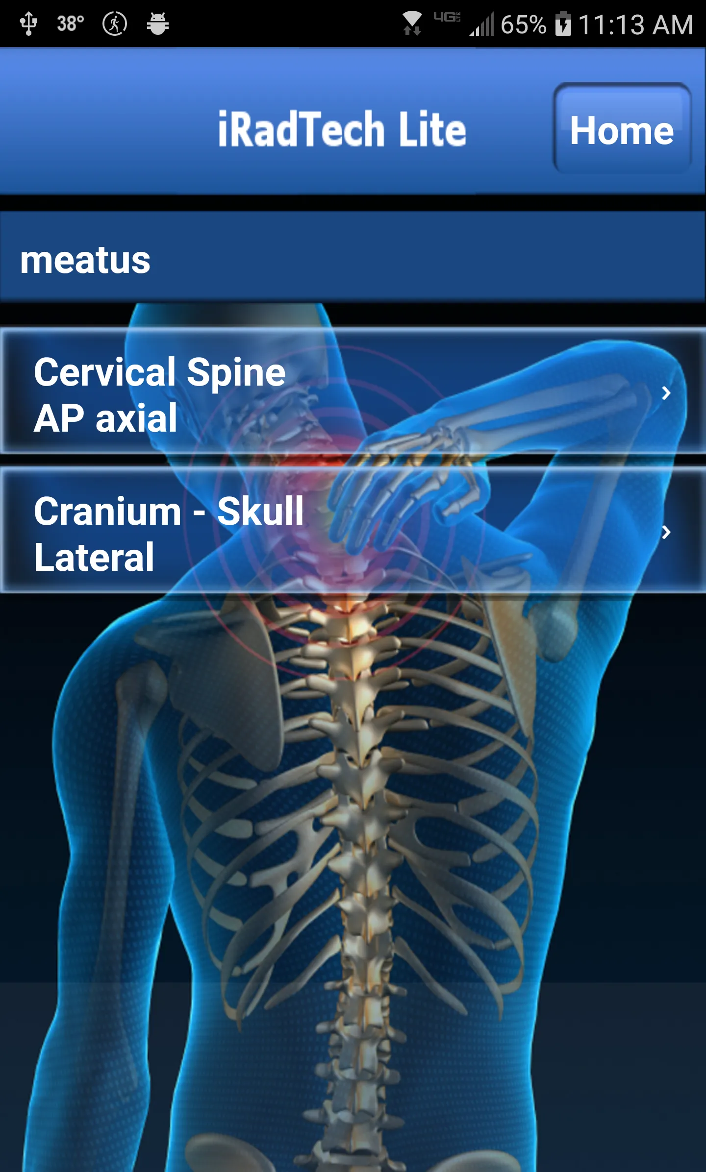 iRadTech Lite | Indus Appstore | Screenshot