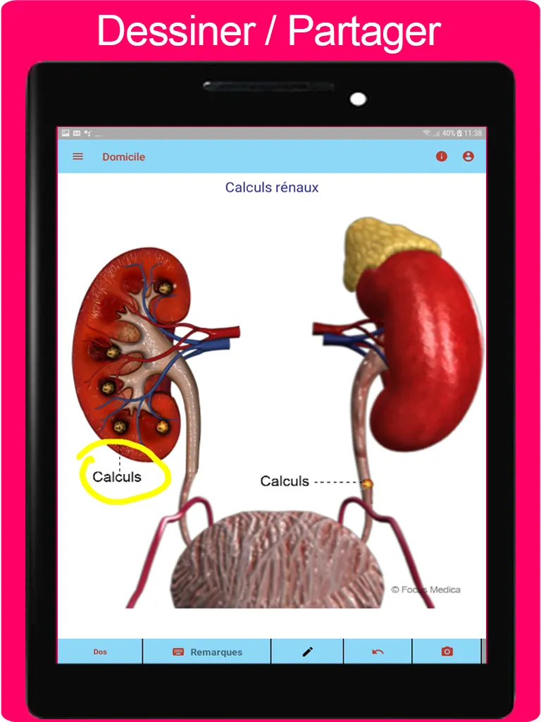 Atlas d'urologie | Indus Appstore | Screenshot