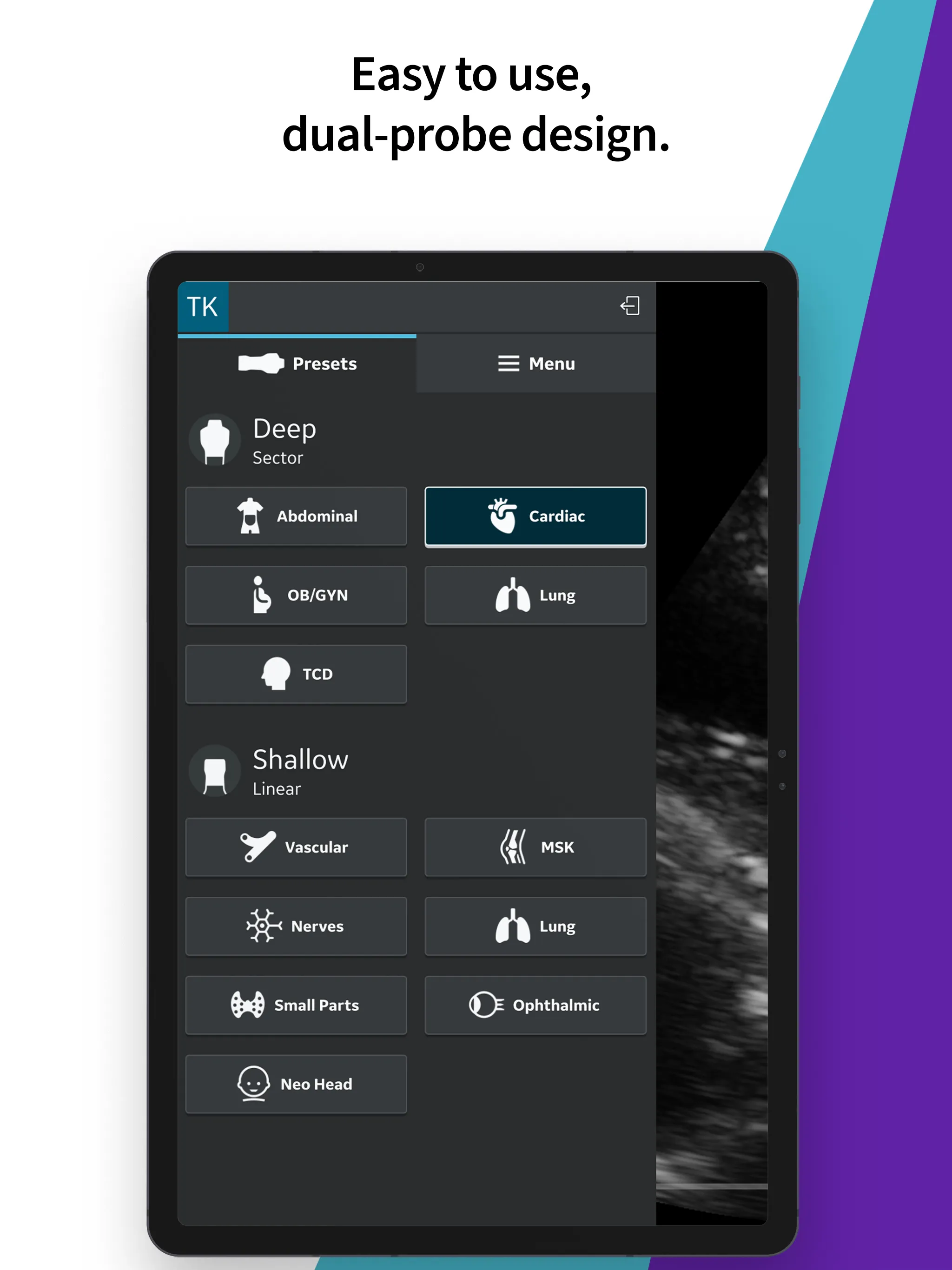 Vscan Air Wireless Ultrasound | Indus Appstore | Screenshot
