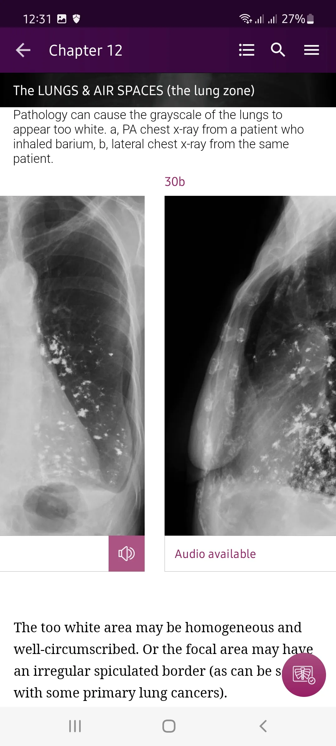 Chest X-Ray DEMO | Indus Appstore | Screenshot