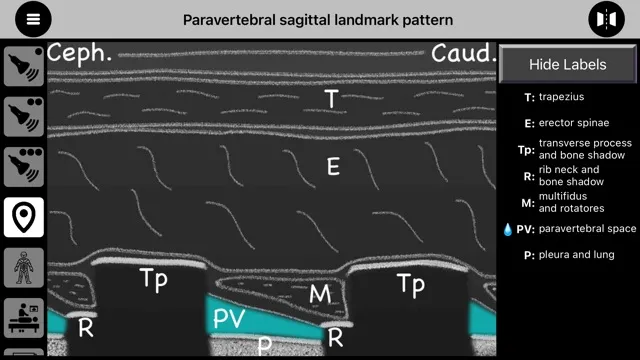 AnSo Anaesthesia Sonoanatomy | Indus Appstore | Screenshot