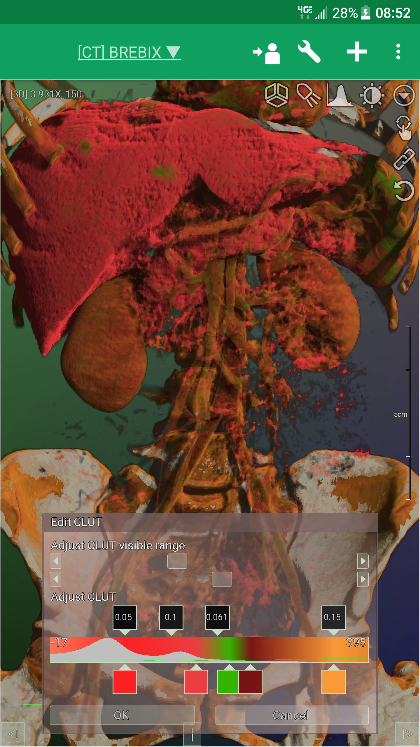 DroidRender - 3D DICOM viewer | Indus Appstore | Screenshot