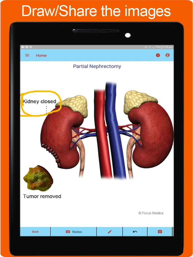 Silodal - Atlas of Urology | Indus Appstore | Screenshot