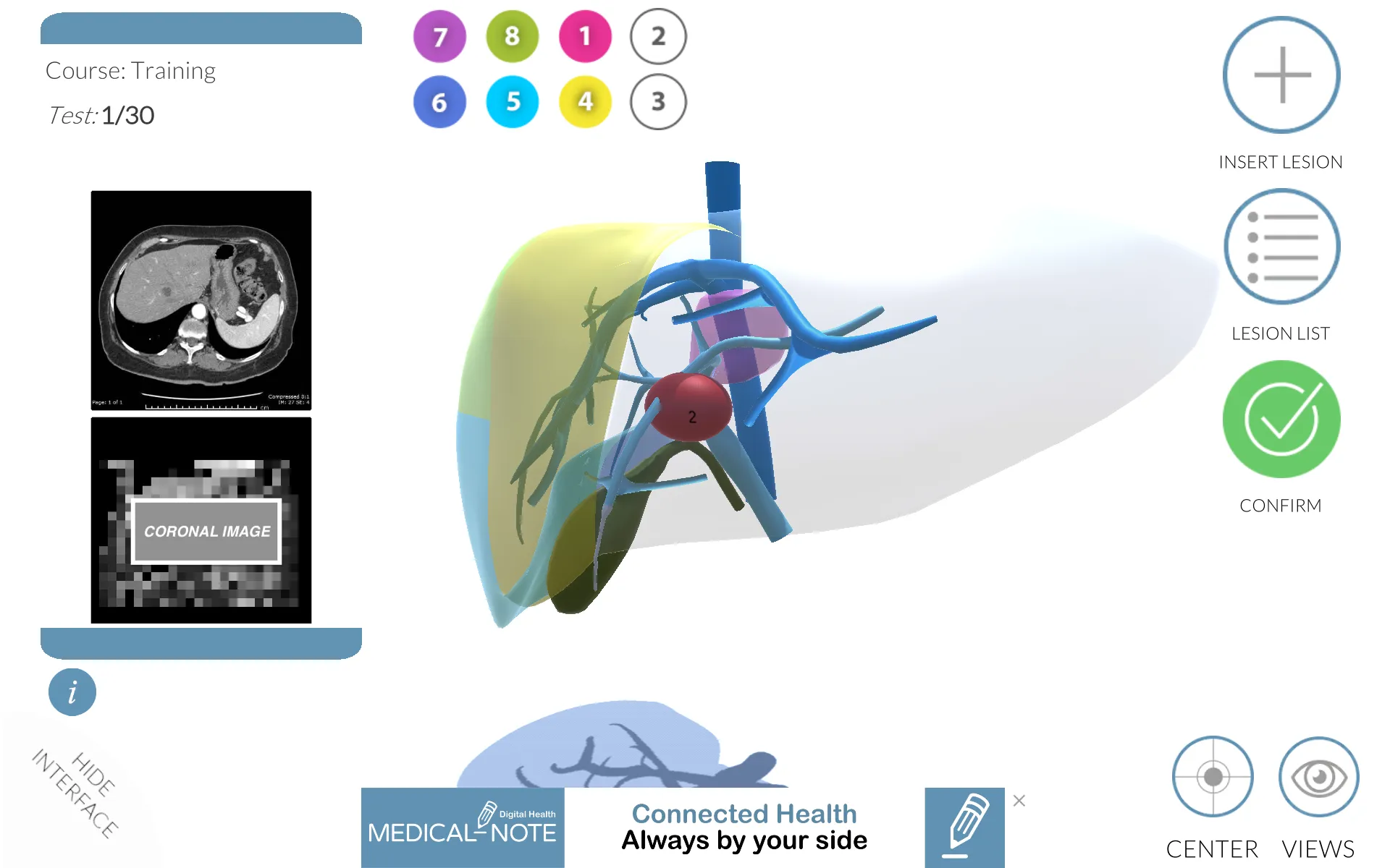 LIVER-NOTE.Edu | Indus Appstore | Screenshot