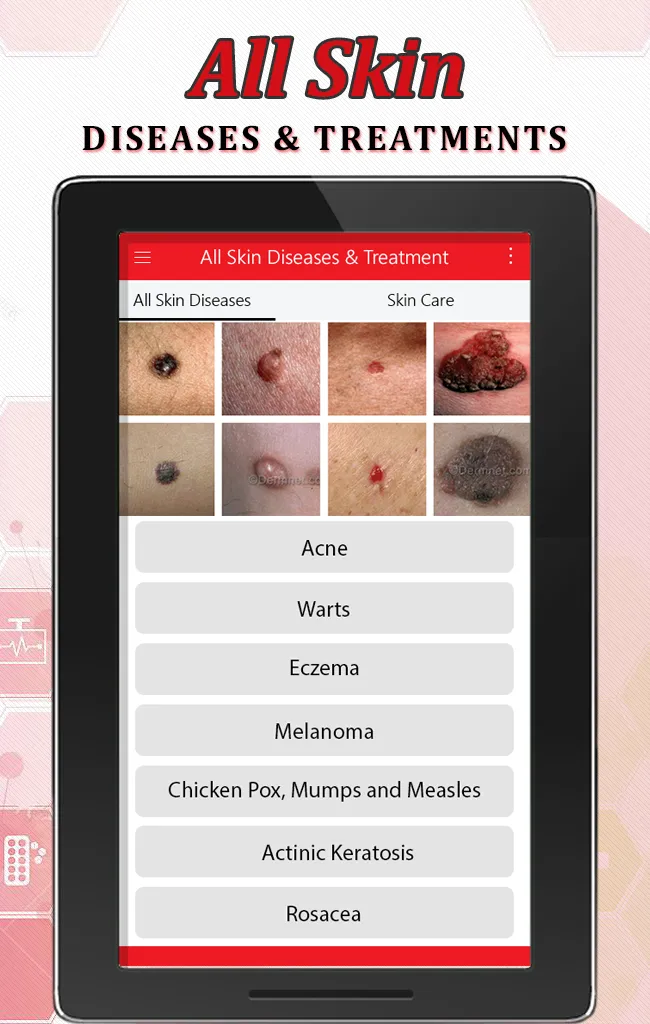 All Skin Diseases & Treatment | Indus Appstore | Screenshot