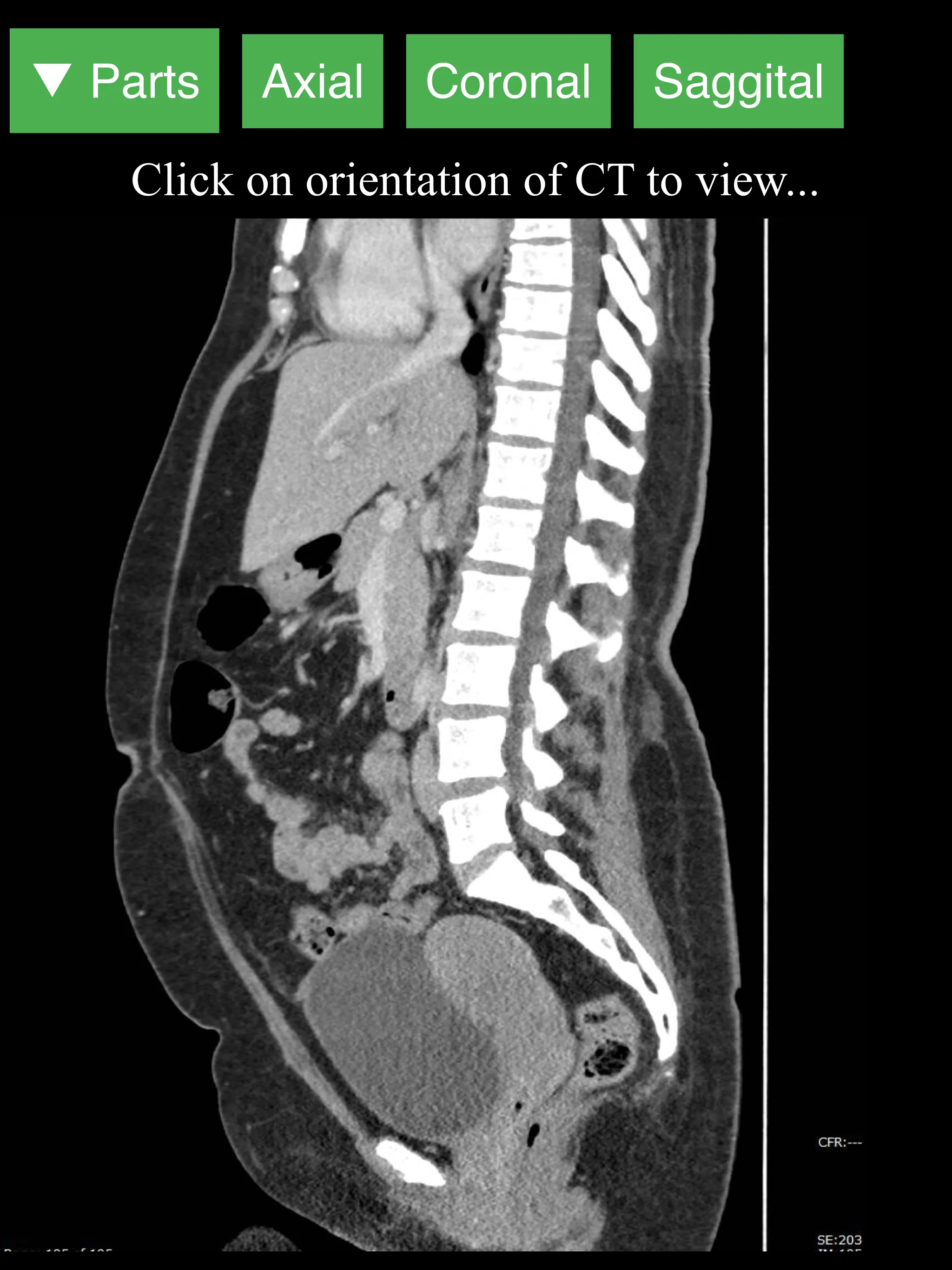 Radiology CT Viewer | Indus Appstore | Screenshot