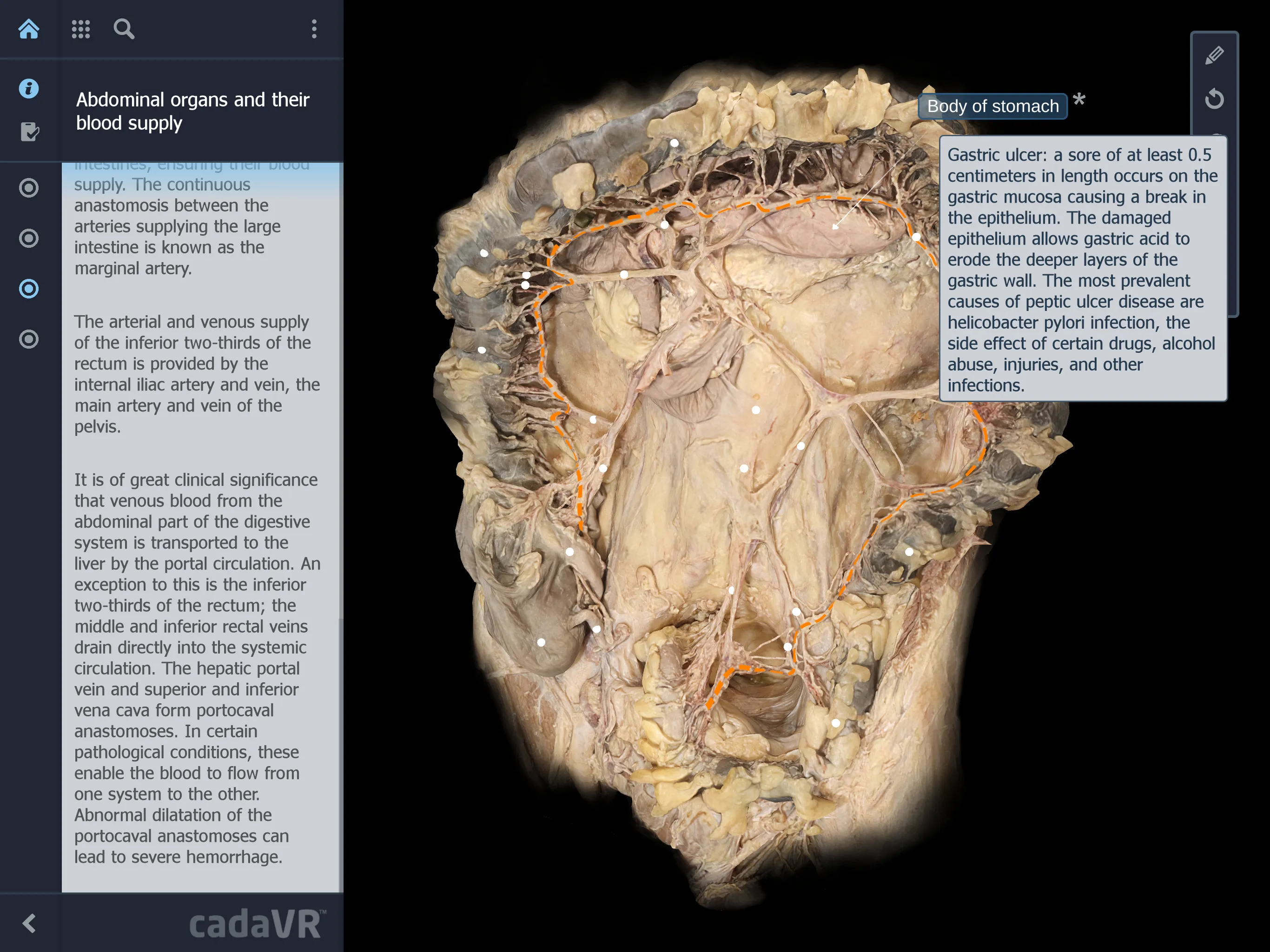 cadaVR anatomy | Indus Appstore | Screenshot