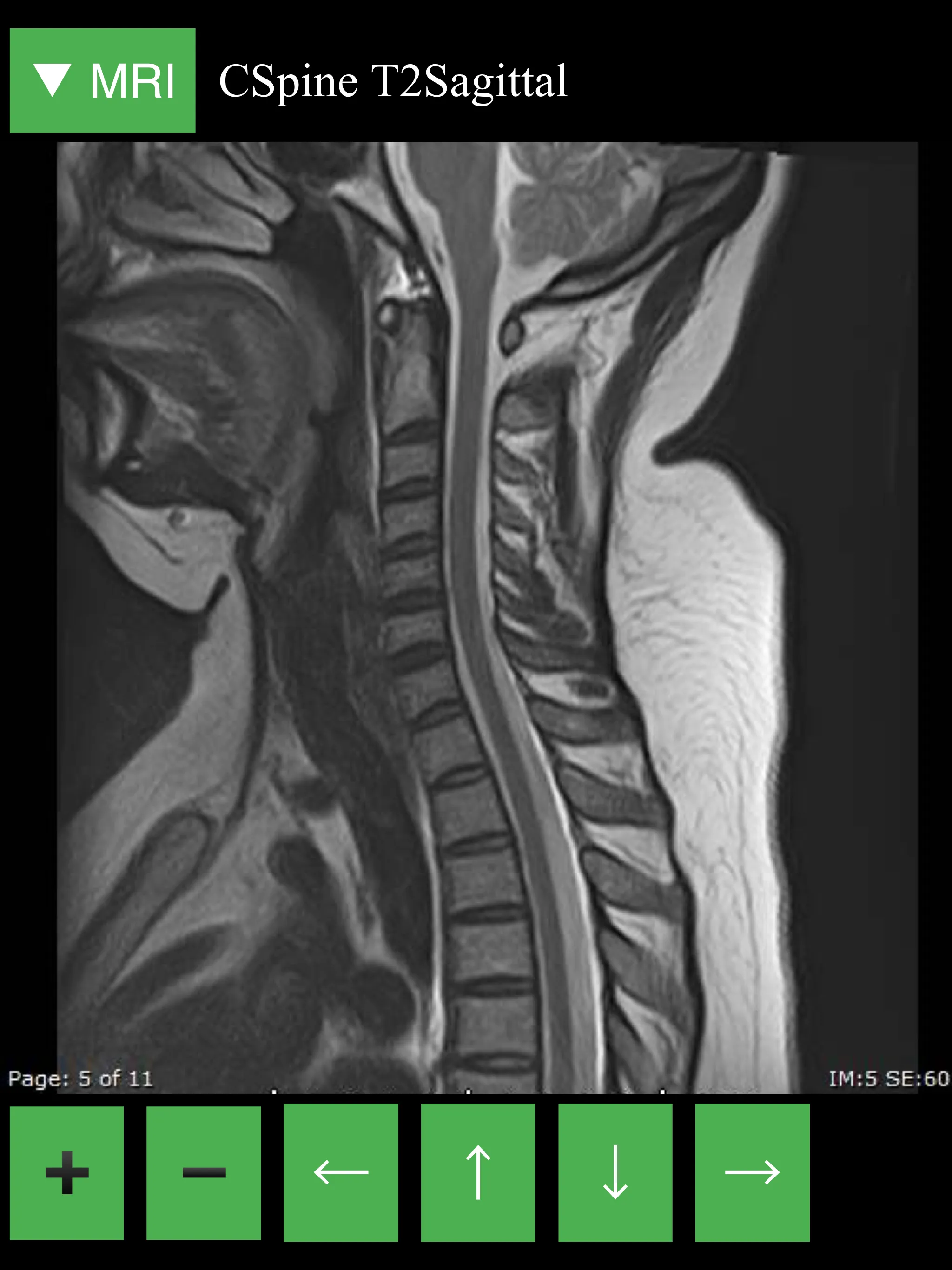 MRI Viewer | Indus Appstore | Screenshot