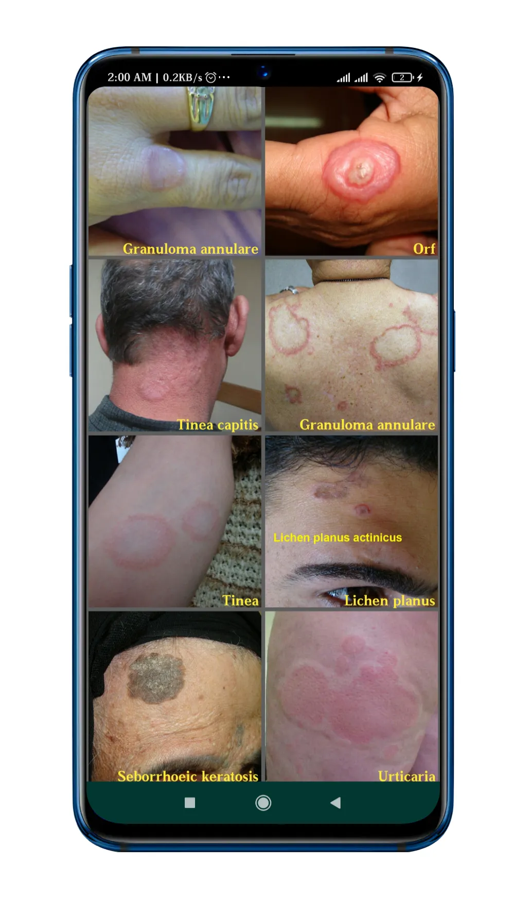 DrugRx (disease,diagnosis) | Indus Appstore | Screenshot