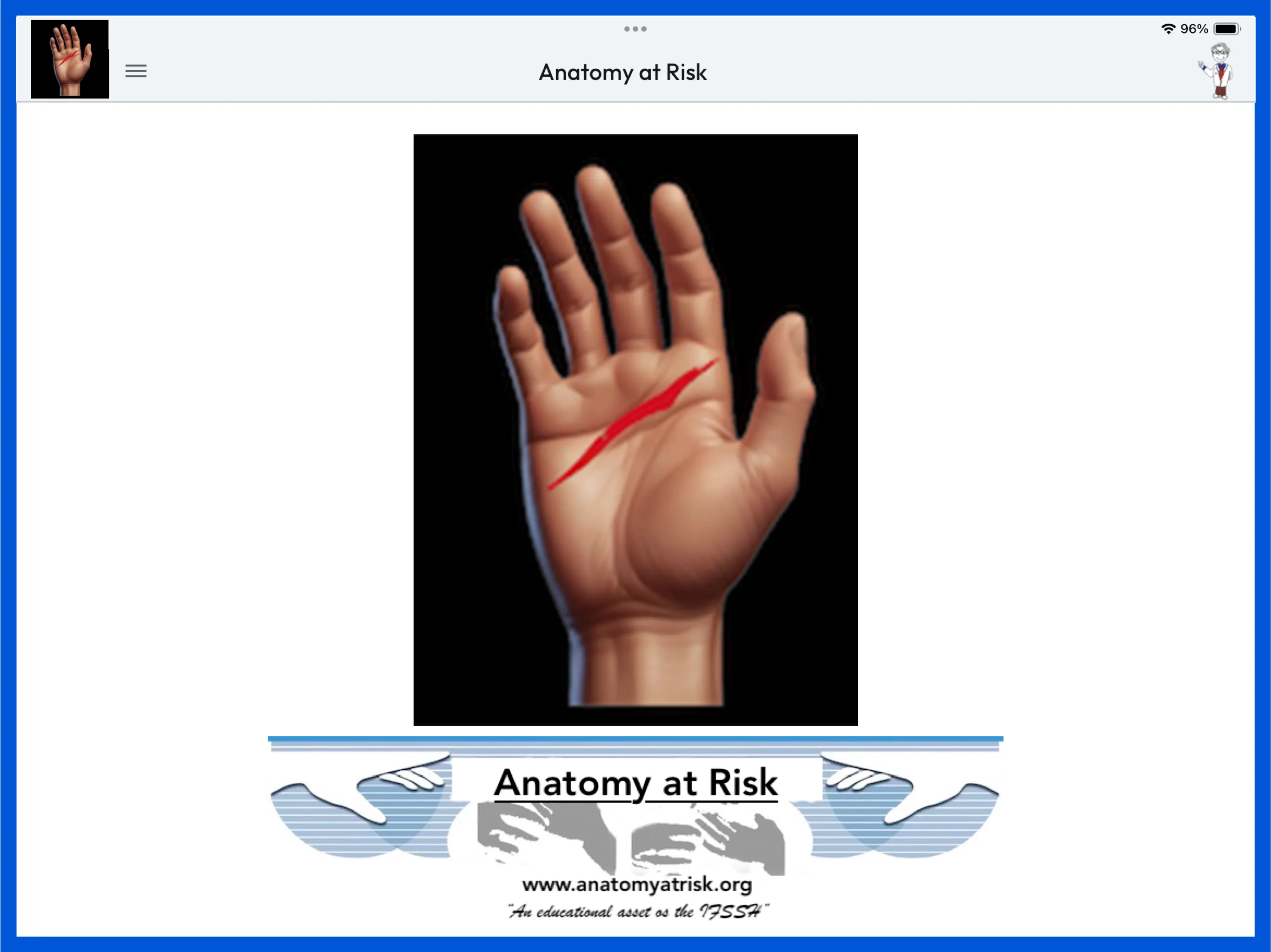 Anatomy at Risk | Indus Appstore | Screenshot
