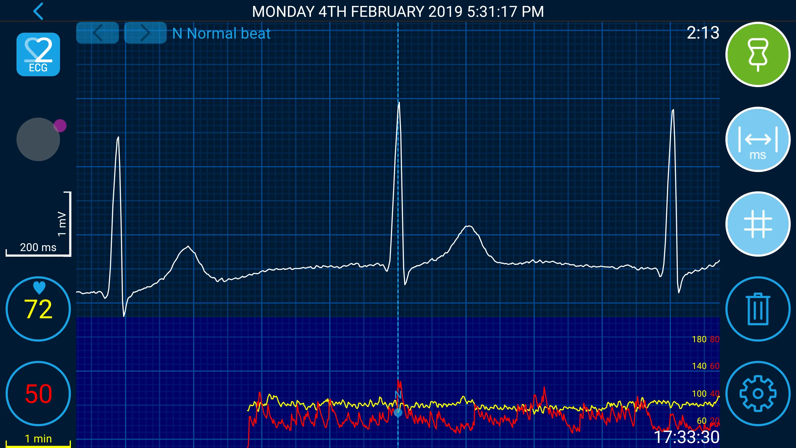 Beat2Phone ECG | Indus Appstore | Screenshot