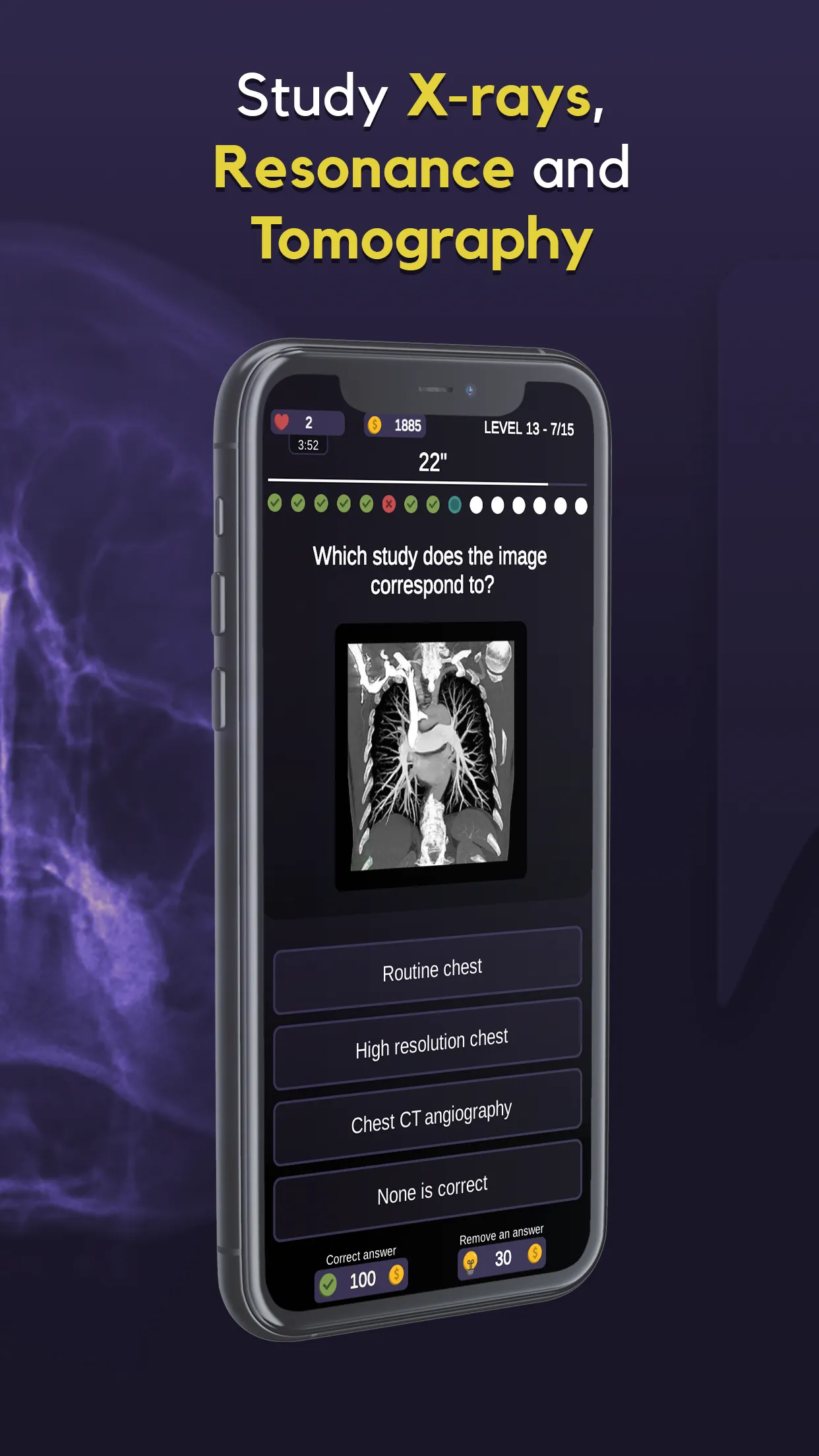 RX Trivia - Radiology Quiz | Indus Appstore | Screenshot